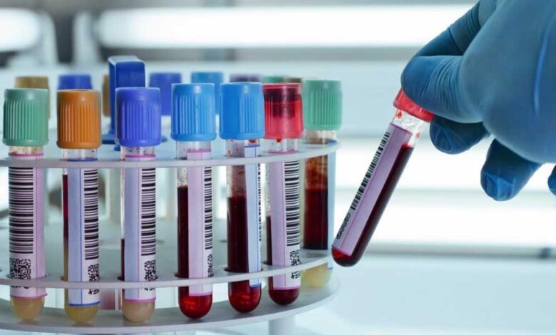 जिला अस्पताल में मरीजों को बड़ी राहत, एक ही छत के नीचे मुफ्त होंगी 196 जांचें