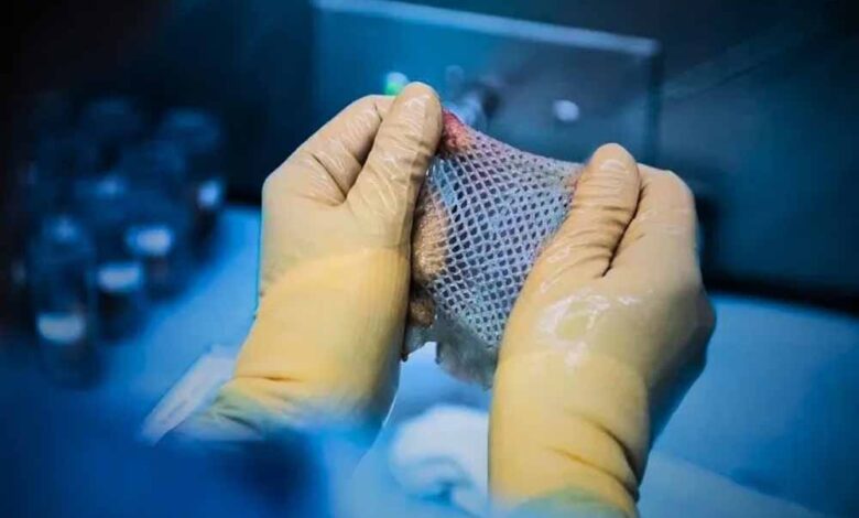 विन्ध्य-क्षेत्र-में-पहली-बार-हुआ-स्किन-डोनेशन