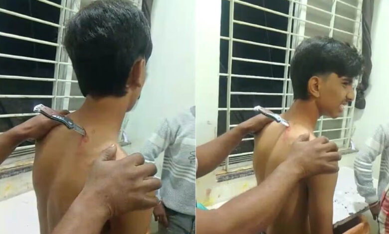 महिदपुर में मामूली विवाद के दौरान नाबालिग पर हमला, घायल 46 किमी दूर अस्पताल पहुंचा